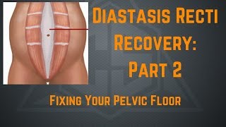 Diastasis Recti Recovery Part 2 Fixing Your Pelvic Floor [upl. by Lairea]