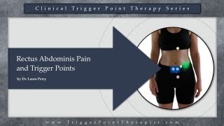 Rectus Abdominis Pain and Trigger Points [upl. by Frye465]