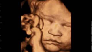 3D ultrasound at 31 weeks GoldenView Ultrasound [upl. by Glialentn461]