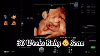 30 Weeks Pregnancy Baby Scan Ultrasound Movement [upl. by Nevil483]