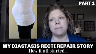 My Diastasis Recti Repair Story  From Exercises to Surgery [upl. by Lareneg75]