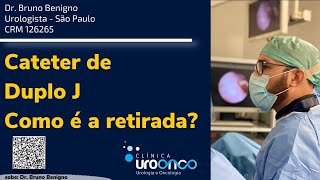 Como é retirado o Cateter de duplo J O que é importante saber para se preparar [upl. by Nochur]